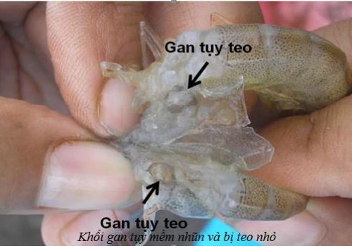 Dấu hiệu nhận biết hội chứng hoại tử gan tụy cấp tính (AHPNS) ở tôm nuôi