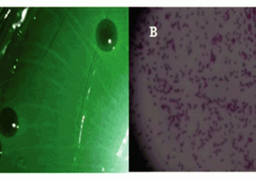 Giải pháp kiểm soát bệnh do vi khuẩn Vibrio