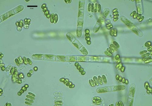 Tầm quan trọng của kiểm soát thực vật phù du trong hệ sinh thái ao nuôi thủy sản