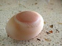 chan-doan-benh-qua-vo-trung-1