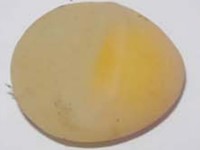 chan-doan-benh-qua-vo-trung-7