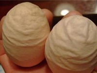 chan-doan-benh-qua-vo-trung-8