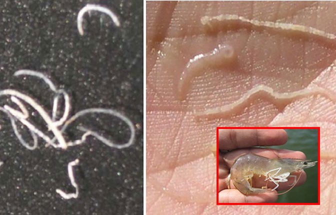 dau-hieu-benh-phan-trang