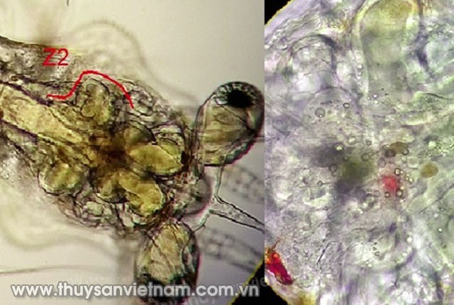 phong-tri-hoi-trung-zoe222