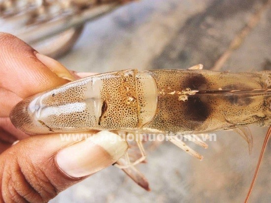 tom-the-chan-trang-bi-benh-gan